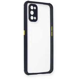 Newface Realme 7 Pro Miami Şeffaf Silikon Lacivert Cep Telefonu Kılıfı