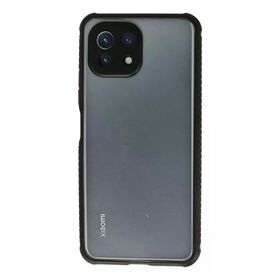 Newface Xiaomi Mİ 11 Lite Miami Şeffaf Silikon Siyah Kılıf