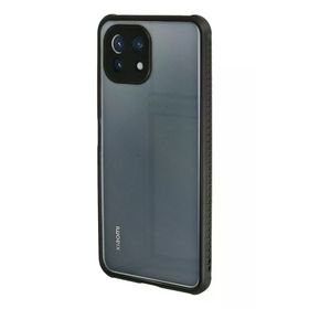 Newface Xiaomi Mİ 11 Lite Miami Şeffaf Silikon Siyah Kılıf