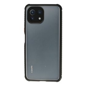 Newface Xiaomi Mİ 11 Lite Miami Şeffaf Silikon Siyah Kılıf
