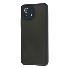 Newface Xiaomi Mi 11 Lite Montreal Silikon Kapak Lacivert Kılıf