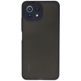 Newface Xiaomi Mi 11 Lite Montreal Silikon Kapak Lacivert Kılıf