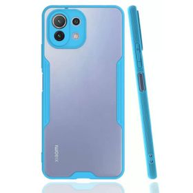 Newface Xiaomi Mİ 11 Lite Platin Silikon Mavi Cep Telefonu Kılıfı