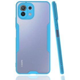 Newface Xiaomi Mİ 11 Lite Platin Silikon Mavi Cep Telefonu Kılıfı