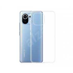 Newface Xiaomi Mi 11 Lüx Şeffaf Silikon Kılıf