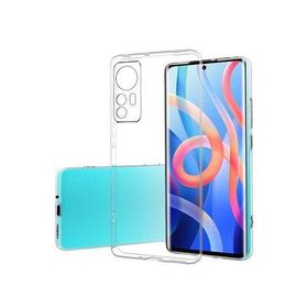 Newface Xiaomi Mi 12X Lüx Şeffaf Silikon Cep Telefonu Kılıfı