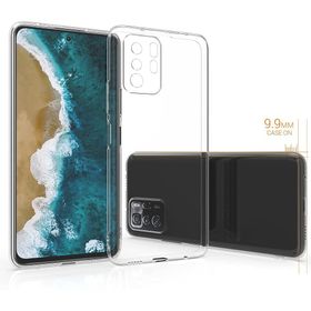 Newface Xiaomi Poco X3 GT Lüx Şeffaf Silikon Cep Telefonu Kılıfı