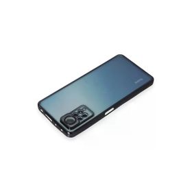 Newface Xiaomi Redmi Note 11 Pro Razer Lensli Silikon Siyah Cep Telefonu Kılıfı