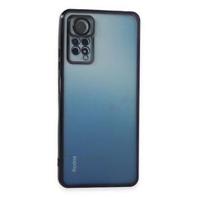 Newface Xiaomi Redmi Note 11 Pro Razer Lensli Silikon Siyah Cep Telefonu Kılıfı
