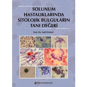 Nobel Tıp Kitabevi Solunum Hastalıklarında Sitolojik Bulguların Tanı Değeri