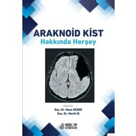 Nobel Tıp Kitabevleri Araknoid Kist Hakkında Herşey