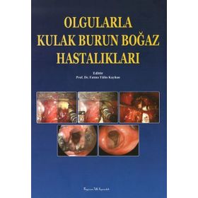 Nobel Tıp Kitabevleri Kulak Burun Boğaz