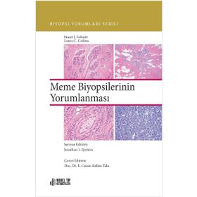 Nobel Tıp Kitabevleri Meme Biyopsilerinin Yorumlanması