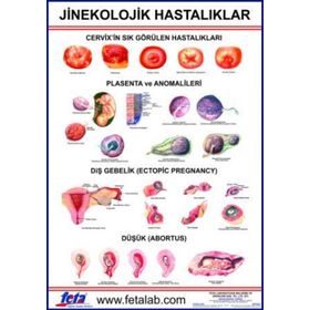 Olgularla Jinekolojik Hastalıklarda Bakım-Ankara Nobel Tıp Kitabevleri