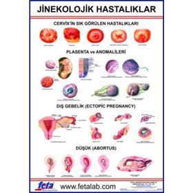 Olgularla Jinekolojik Hastalıklarda Bakım-Ankara Nobel Tıp Kitabevleri