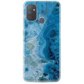 OnePlus Nord N100 Mavi Kılıf Auto Focus Serisi Soft Premium Standlı Yüzüklü Kapak