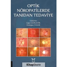 Optik Nöropatilerde Tanıdan Tedaviye - Kollektif