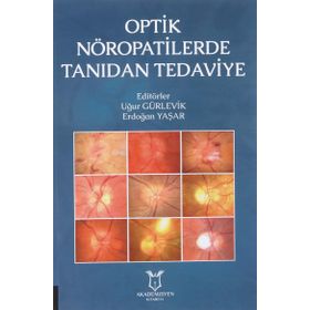 Optik Nöropatilerde Tanıdan Tedaviye - Kollektif