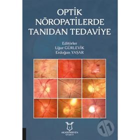 Optik Nöropatilerde Tanıdan Tedaviye - Kollektif
