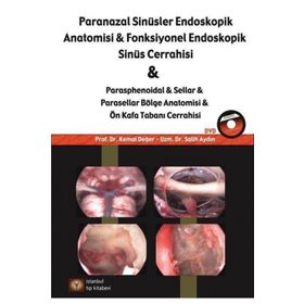 Paranazal Sinüsler Endoskopik Anatomisi ve Fonksiyonel Endoskopik Sinüs Cerrahisi - Kemal Değer