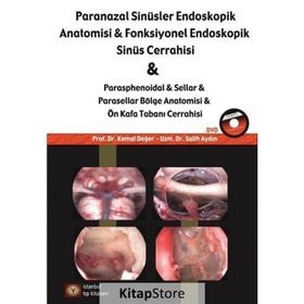 Paranazal Sinüsler Endoskopik Anatomisi ve Fonksiyonel Endoskopik Sinüs Cerrahisi - Kemal Değer