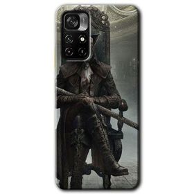 Poco M4 Pro 5G Bloodborne Hunters Baskılı Uyumlu Silikon Kılıf