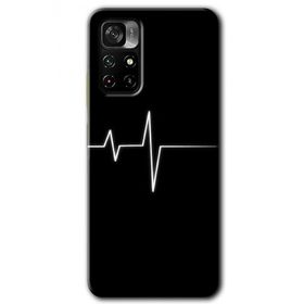 Poco M4 Pro 5G Heart Rytm Baskılı Uyumlu Silikon Kılıf