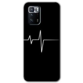 Poco X3 GT Heart Rytm Baskılı Uyumlu Silikon Kılıf