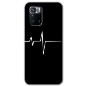 Poco X3 GT Heart Rytm Baskılı Uyumlu Silikon Kılıf