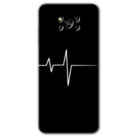 Poco X3 Pro Heart Rytm Baskılı Uyumlu Silikon Kılıf