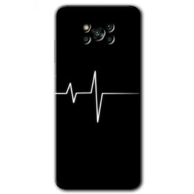 Poco X3 Pro Heart Rytm Baskılı Uyumlu Silikon Kılıf