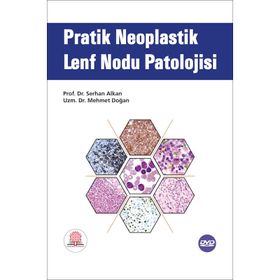 Pratik Neoplastik Lenf Nodu Patolojisi-Ankara Nobel Tıp Kitabevleri