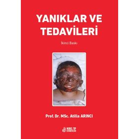 Prof. Dr. MSc. Atilla Arıncı Yanıklar ve Tedavileri