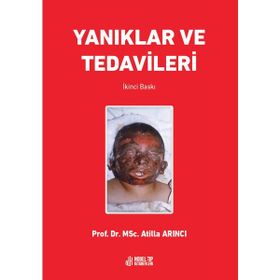 Prof. Dr. MSc. Atilla Arıncı Yanıklar ve Tedavileri