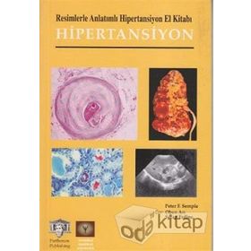 RESIMLERLE ANLATIMLI HIPERTANSIYON EL KİTABI - SERAP ERDINE