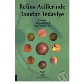 Retina Acillerinde Tanıdan Tedaviye - Kolektif