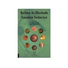 Retina Acillerinde Tanıdan Tedaviye - Kolektif
