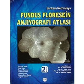 Sankara Nethralaya Fundus Floresein Anjiyografi Atlası - Pukraj Rishi Ekta Rishi Tarun Sharma Muna Bhende Parveen Sen Dhanashree Ratra Lingam Copal