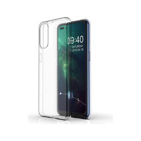 Teleplus Oppo Reno 5 Pro 5G Lüks Tpu Şeffaf Silikon Cep Telefonu Kılıf