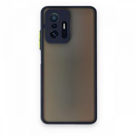Teleplus Xiaomi 11T Hux Kamera Korumalı Silikon Siyah Kılıf