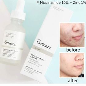 The Ordinary Niacinamide 10% ve Zinc 1 30 ml Solüsyon