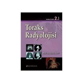 Toraks Radyolojisi - Nobel Tıp Kitabevi