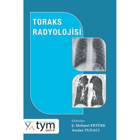 Toraks Radyolojisi - Nobel Tıp Kitabevi