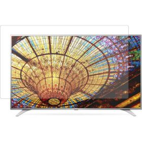 TV Guard LG 43UH650V 43 inç TV Ekran Koruyucu