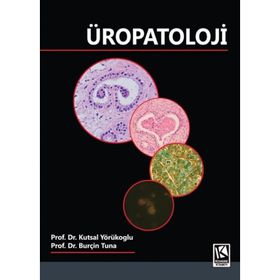 Üropatoloji - YÖRÜKOĞLU TUNA