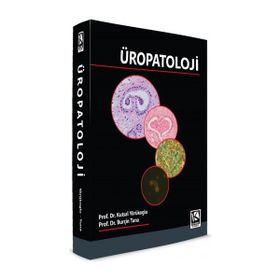 Üropatoloji - YÖRÜKOĞLU TUNA