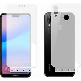 Winex Honor X20 Ön Darbe Emici Hd Ekran Koruyucu Kaplama