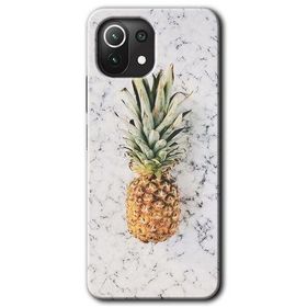 Xiaomi Mi 11 Ananas Baskılı Uyumlu Silikon Kılıf