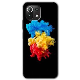 Xiaomi Mi 11 Black 1 Baskılı Uyumlu Silikon Kılıf