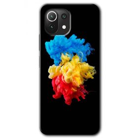 Xiaomi Mi 11 Black 1 Baskılı Uyumlu Silikon Kılıf